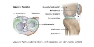 Abb. 1: Meniskus Aufbau; Quelle (1)